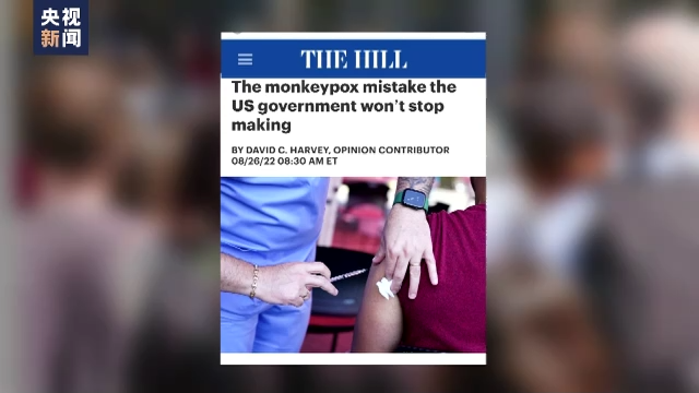 美国猴痘病例超1.7万例 美媒称美政府正重蹈覆辙